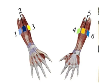Hybrid Machine-Learning Approach Gives a Hand to Prosthetic-Limb Gesture Accuracy