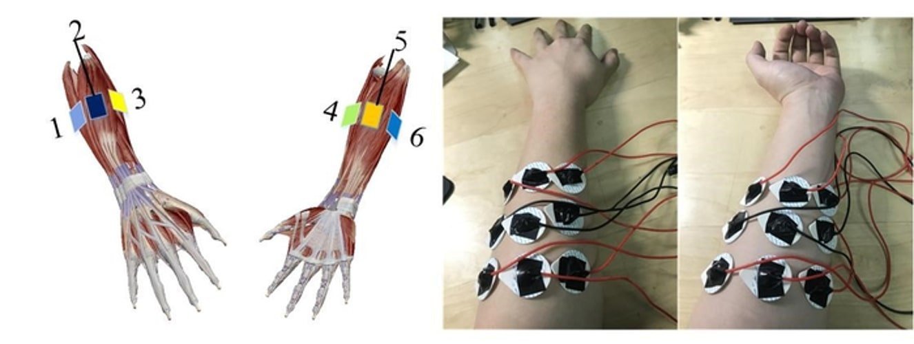 This shows an arm covered in electrodes